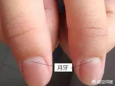 指甲上的月牙少是不健康吗_指甲上的月牙少是不健康吗图片