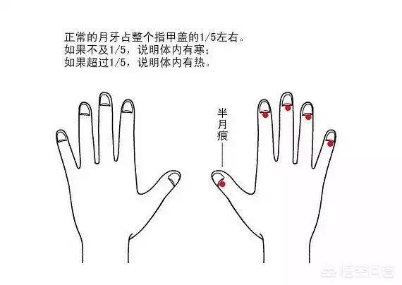 指甲上的月牙少是不健康吗_指甲上的月牙少是不健康吗图片