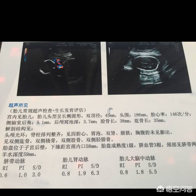小半月_小半月是多久